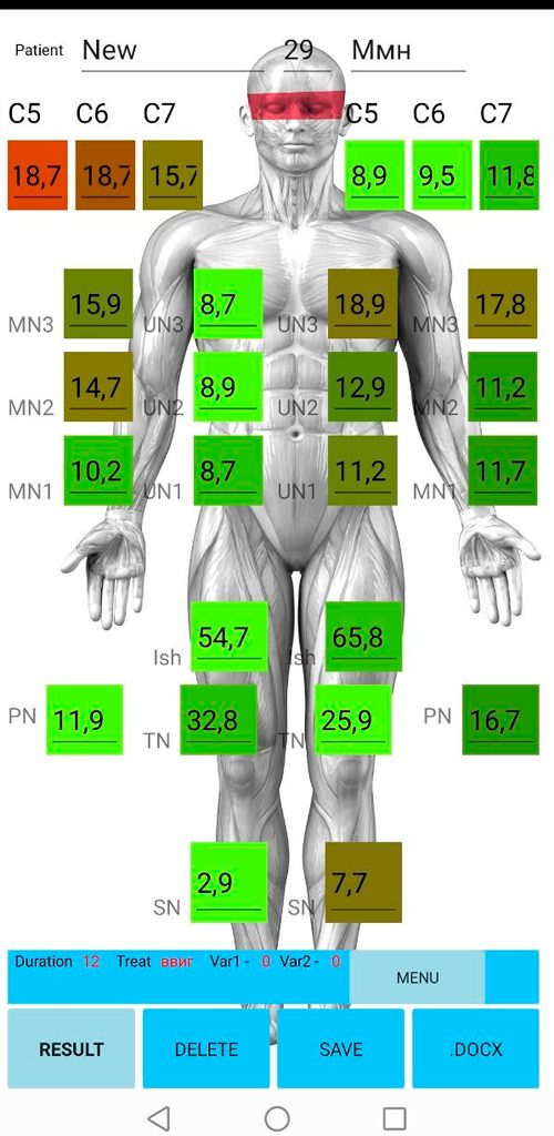 High-Resolution Sonography PN screenshot