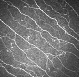 Демонстрация метода конфокальной микроскопии тонких С-волокон