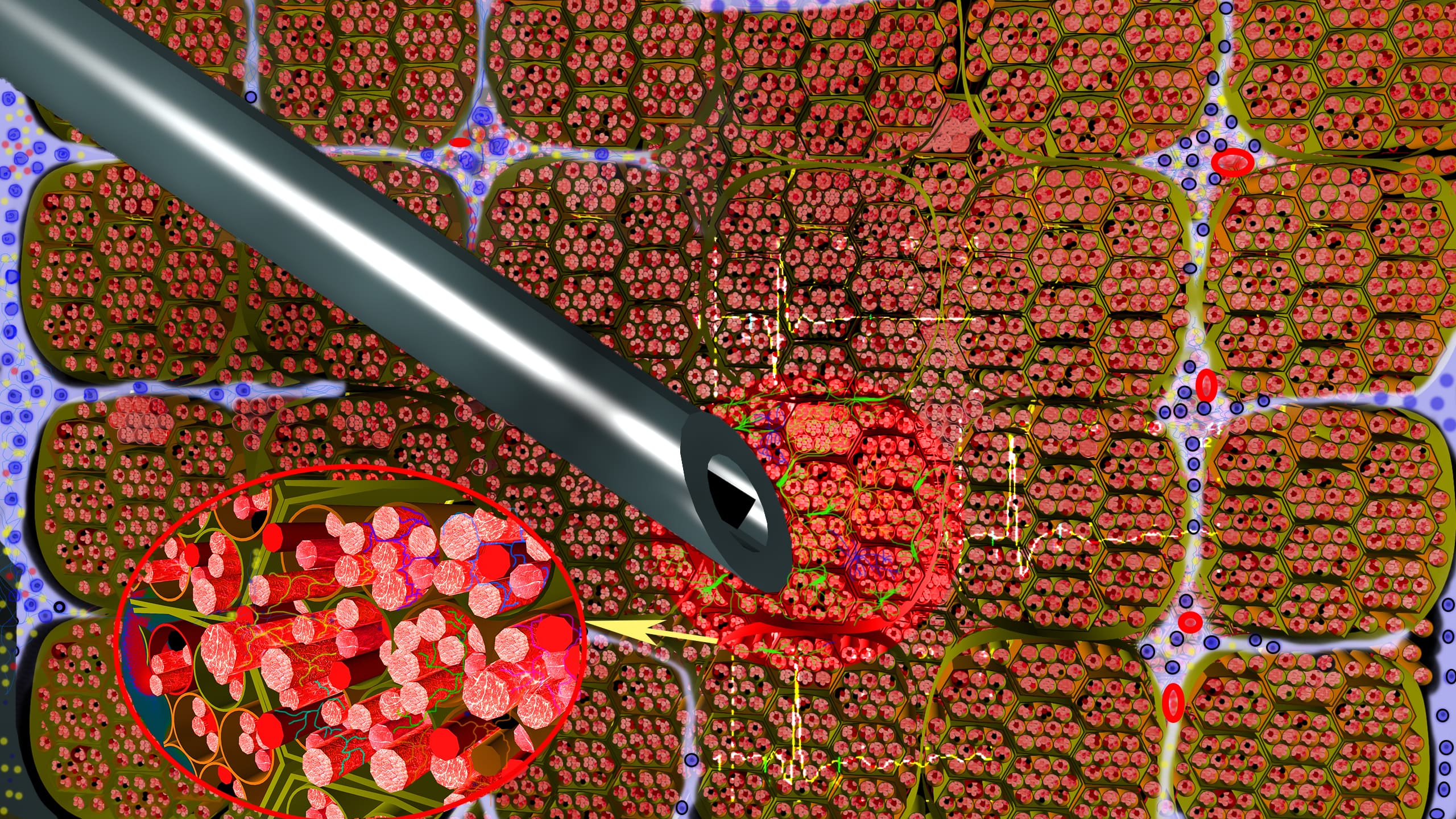 Расположение концентрического игольчатого электрода относительно мышечных волокон