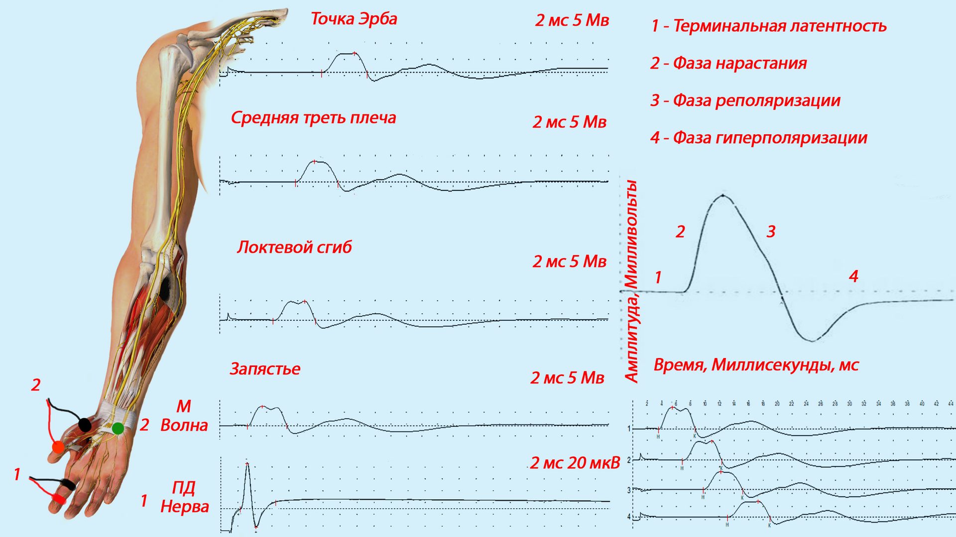 EMG stimulasi
